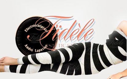 Anticelulit tretmani, Elektroskulptura: Celulit i kako ga se rešiti