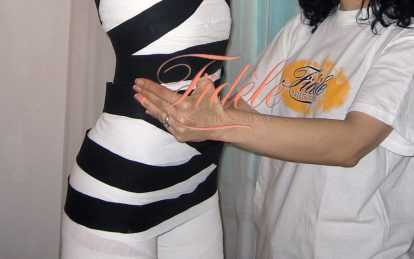 Anticelulit tretmani, kako se resiti celulita stomaku